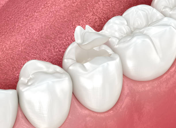 Best Dentures (Full and Partial)  in Navasota, TX